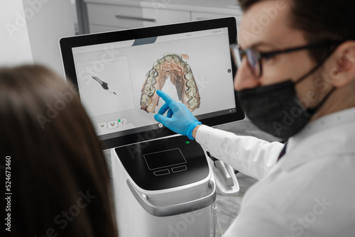Male doctor show results of digital intraoral scan of patient teeth in 3D on display.