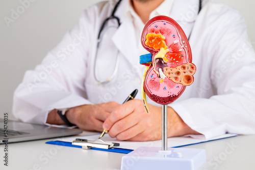 Tableau sur toile mockup kidney on work desk of doctor