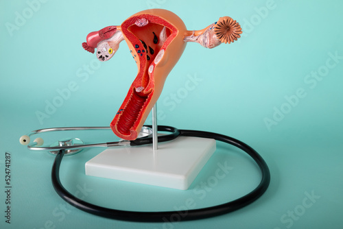 model of female reproductive system and stethoscope lies on a blue background photo