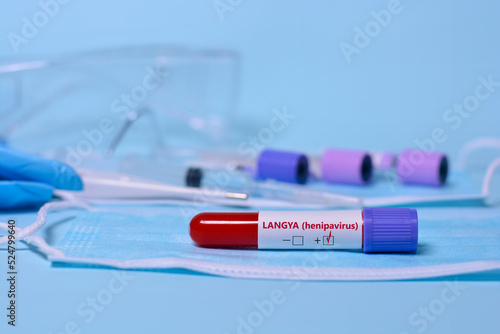 A test blood sample tube with positive Langya henipavirus (LayV) . A test tube on a medical mask on the background of test tubes, thermometer, syringe, medical glasses. photo