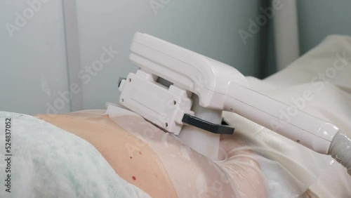 Beauty clinic fat treatment. Woman getting cryolipolysis in professional cosmetic cabinet or spa center. Cryotherapy, beautician performing procedure on patient. Female patient lying on couch. 4 k photo