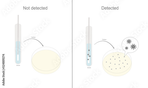 The result of pathogen culture (virus, bacteria, etc.) of unknown sample in the test tube with a swab stick that show detected or not-detected.