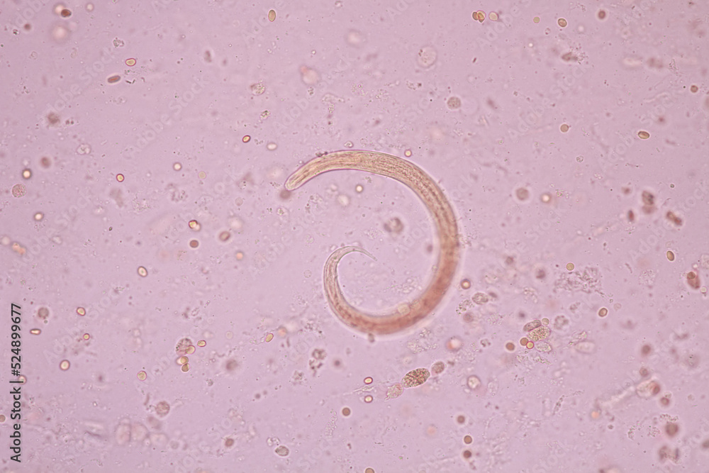 View in microscopic Strongyloides stercoralis or threadworm in human