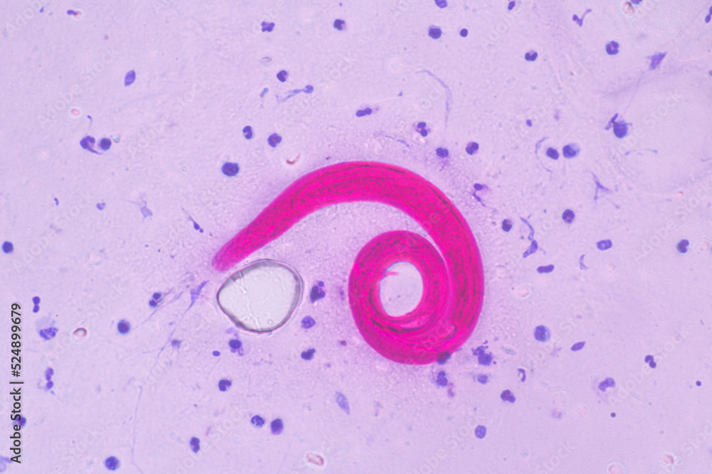 View in microscopic Strongyloides stercoralis or threadworm in human
