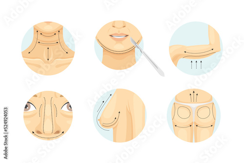 Plastic Surgery as Restoration and Reconstruction of Human Body Part in Circle Vector Set