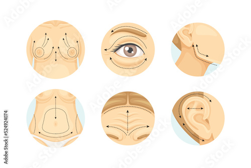 Plastic Surgery as Restoration and Reconstruction of Human Body Part in Circle Vector Set