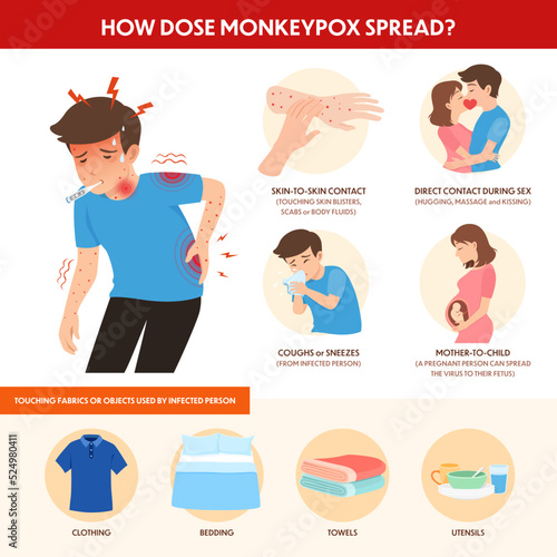 Infographics of how monkeypox outbreak can spread though? photo