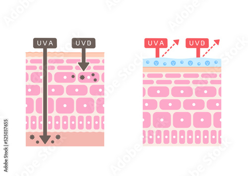 肌構造のイラスト 皮膚への紫外線のダメージとUVケア