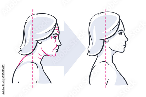 Womans face profile before and after. Young and elderly image of skin aging. Vector illustration isolated on white background.