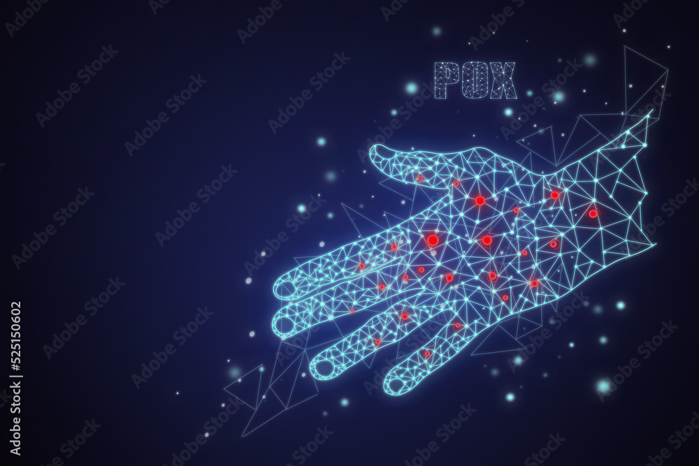 2d polygonal neon hand with chicken pox. Digital image on dark blue space background. Concept of smallpox disease, skin rash, vaccination. Copy space 2d polygonal neon hand with chicken pox. Digital image on dark blue space background. Concept of smallpox disease, skin rash, vaccination. Copy space