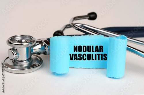 On a white surface lies a stethoscope and a blue roll of paper with the inscription - Nodular vasculitis photo