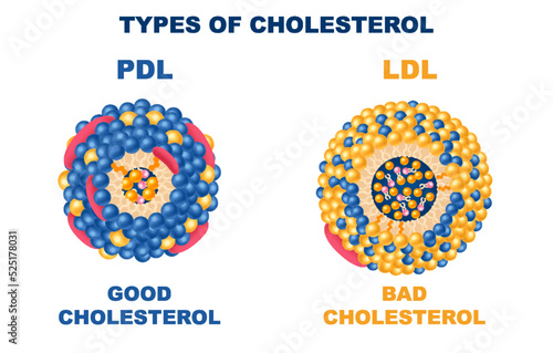 Cholesterol Types Set