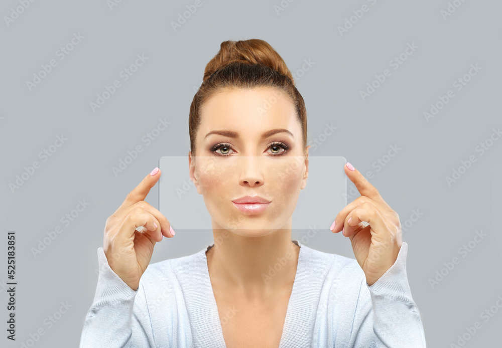 Dark spots, freckles,hyperpigmentation(melasma or chloasma),concept - skin lightening, skin whitening, fruit acids,AHA, Skin Brightening Dark spots, freckles,hyperpigmentation(melasma or chloasma),concept - skin lightening, skin whitening, fruit acids,AHA, Skin Brightening