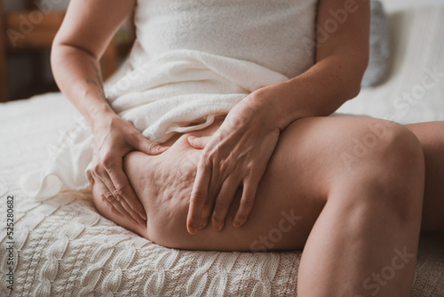 Close-up of female body with cellulite, woman makes massage against cellulite with her hands. © Natalya