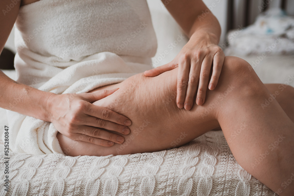 Close-up of female body with cellulite, woman makes massage against cellulite with her hands. Close-up of female body with cellulite, woman makes massage against cellulite with her hands.