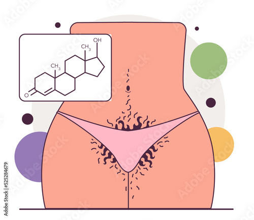 Intimate hygiene. Female body with high level of testosterone, hirsutism