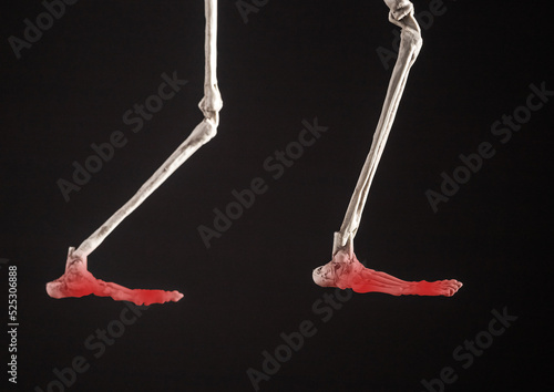 Human skeleton legs with painful feet with red point on black background. Profile view. Injury, overuse, bones inflammation. Bunions, metatarsalgia, fracture, tendonitis photo