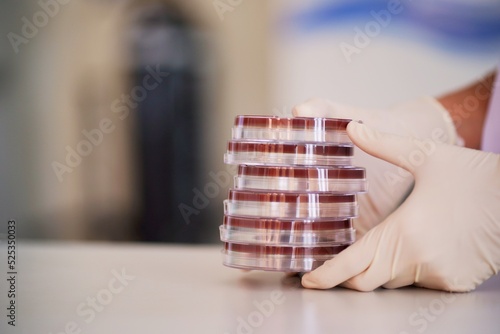Fényképezés Laboratory worker holding a culture plate with bacteria or viruses growing on agar in petri dish for making a blood culture in a petri dish, Laboratory and Medical concepts