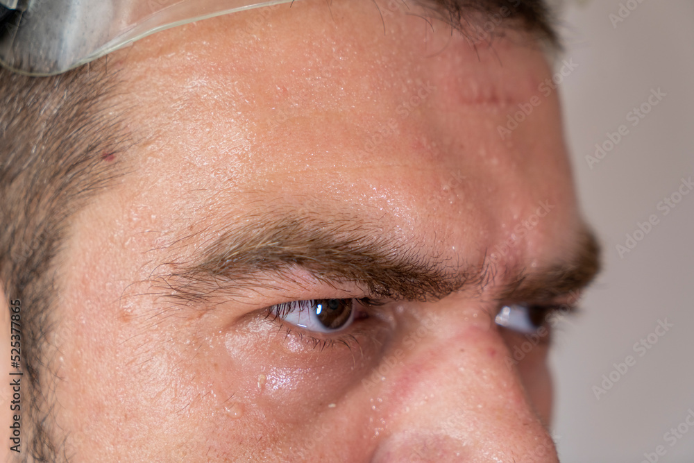 Obraz premium Sweaty, exhausted face with safety equipment marks.