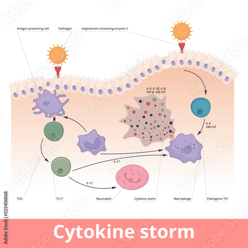 Cytokine storm. Hypercytokinemia during which the immune system causes a release of cytokines with help of macrophages, t helper cells, neutrophils. photo
