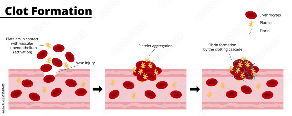 Clot formation process after a bleeding vascular injury Platelet Clot formation process after a bleeding vascular injury Platelet