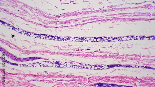 Microscopic 100x view of human skin with shown sweat glands against bright field. Macro footage of epidermis layers multiply magnified for analyzing people perspiration process. Lab investigation