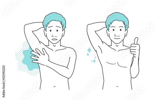 男性　脇・脇の下の悩み 体臭 汗臭い 腋毛 ビフォーアフター セット