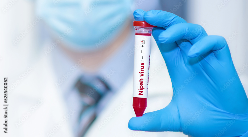Doctor holding a test blood sample tube with positive Nipah.The virus is transmitted from animals to humans or through contaminated food, it can also be transmitted directly from person to person Doctor holding a test blood sample tube with positive Nipah.The virus is transmitted from animals to humans or through contaminated food, it can also be transmitted directly from person to person