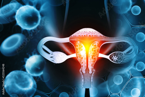 Foto Female reproductive system diseases