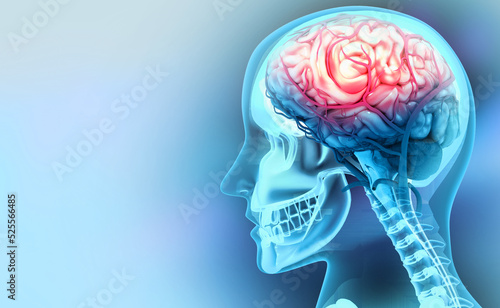 Human brain injury,damage,hemorrhage. 3d illustration photo