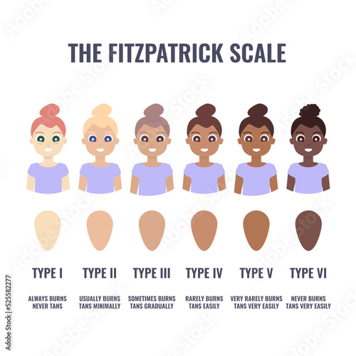 Fitzpatrick skin type classification scale shown in women. Human skin tone pigmentation diversity infographics. Six phototypes from fair to dark complexion variations. Vector cartoon illustration.