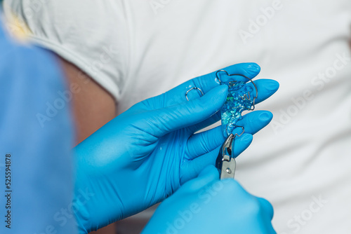 close-up of a dentist preparing braces for a patient.