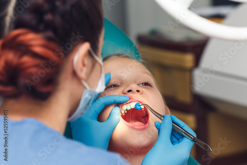 dentist fluoridates a child's teeth. Strengthening of tooth enamel. photo