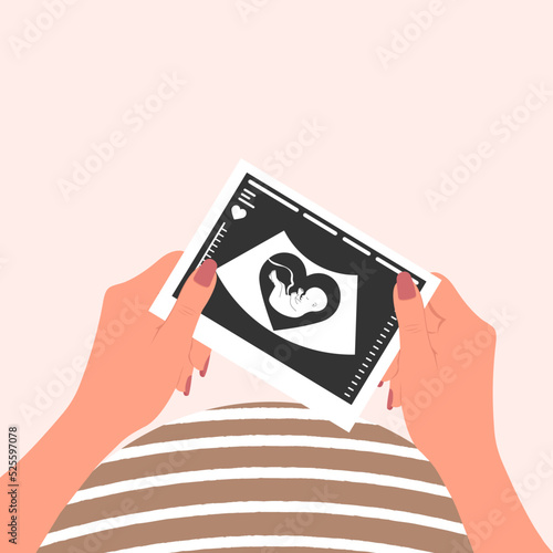 A happy pregnant woman holds a photograph of a fetal ultrasound scan in both hands. Ultrasound picture of the baby. Vector
