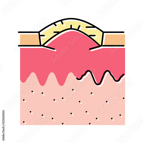 boxcar acne scar color icon vector illustration