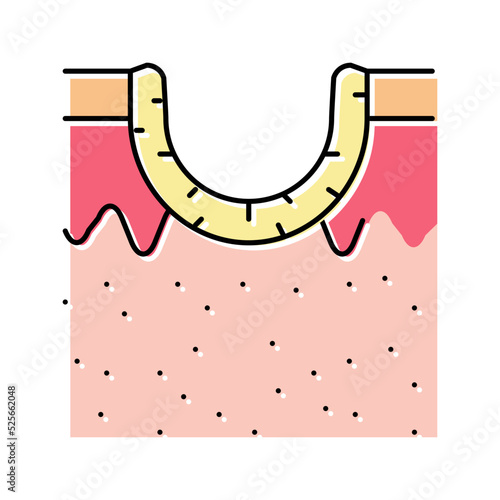 rolling acne scar color icon vector illustration