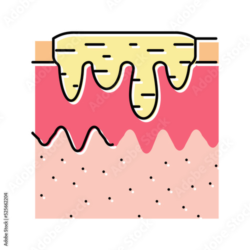 hyperpigmentation acne scar color icon vector illustration