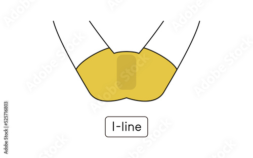 Men's Hair Removal, I-Line, with Underwear