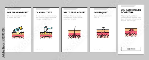 Ingrown Hair Problem Treatment onboarding icons set vector