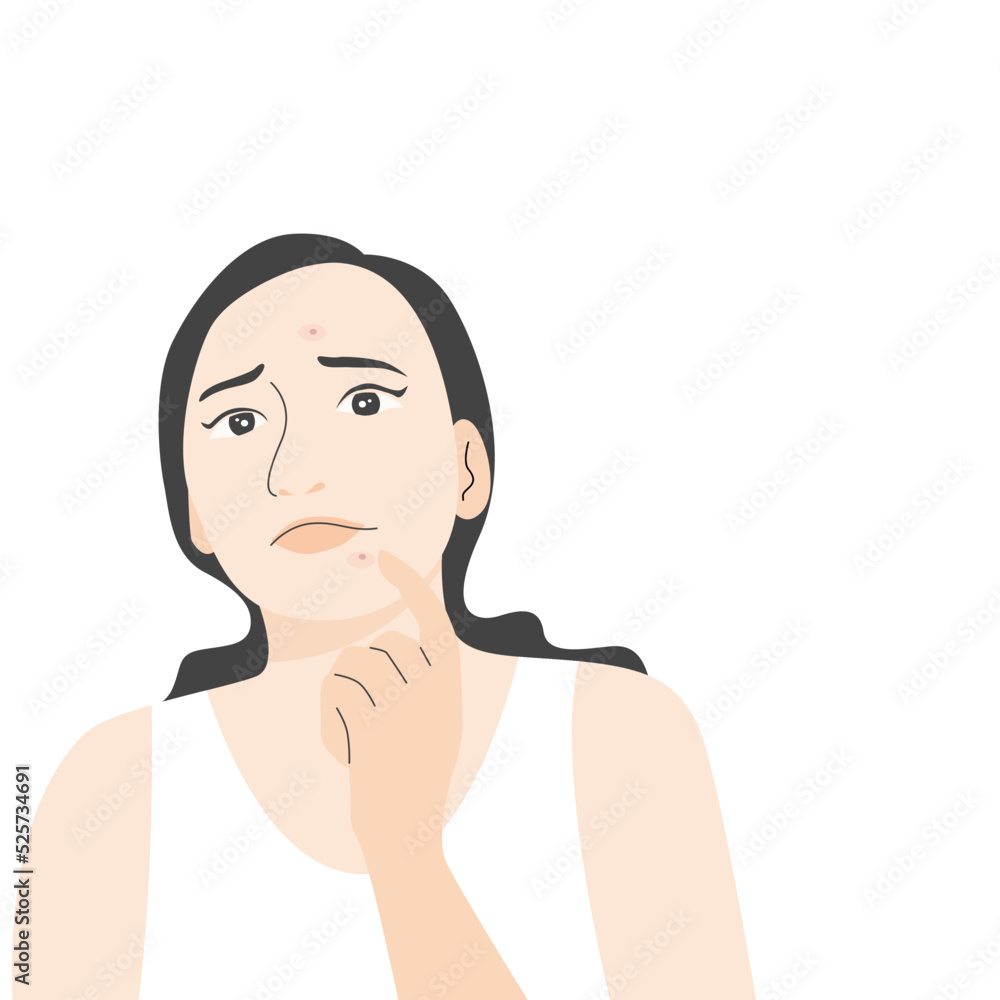 A woman worrying with acne on her face, flat vector illustration.