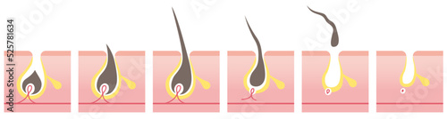 Cross section of hair removal steps. Vector illustration isolated on white background.