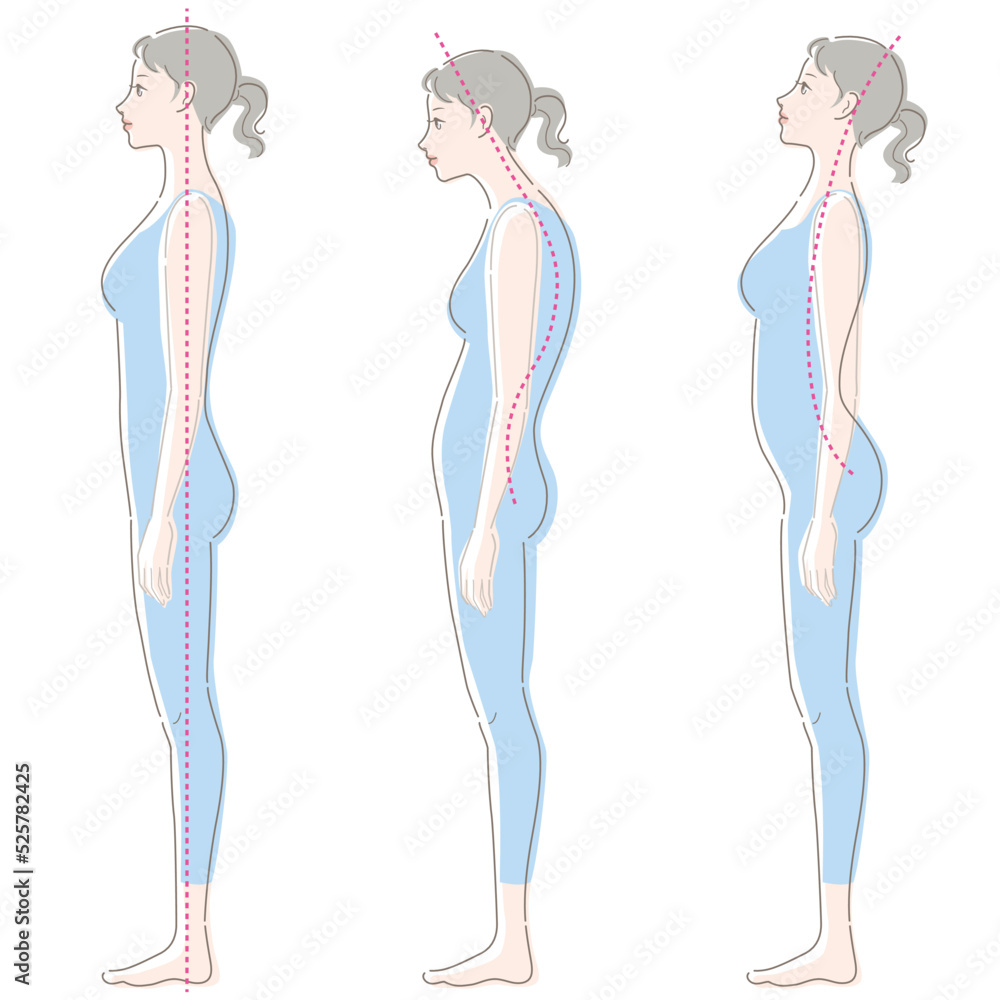 Whole body of young woman. Good posture, bad posture. Vector