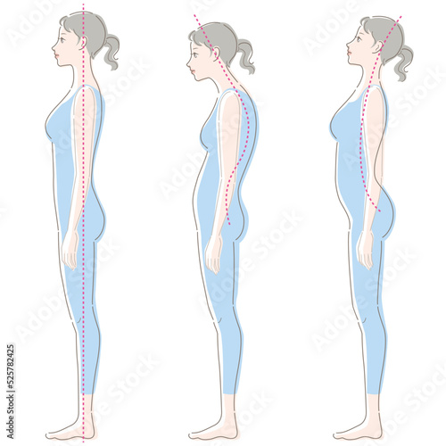 Whole body of young woman. Good posture, bad posture. Vector illustration isolated on white background.