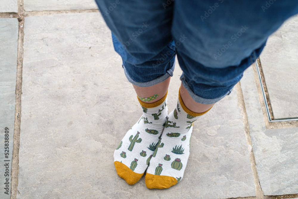 Top view of girl legs with a plaster wearing socks with printed cactus Top view of girl legs with a plaster wearing socks with printed cactus