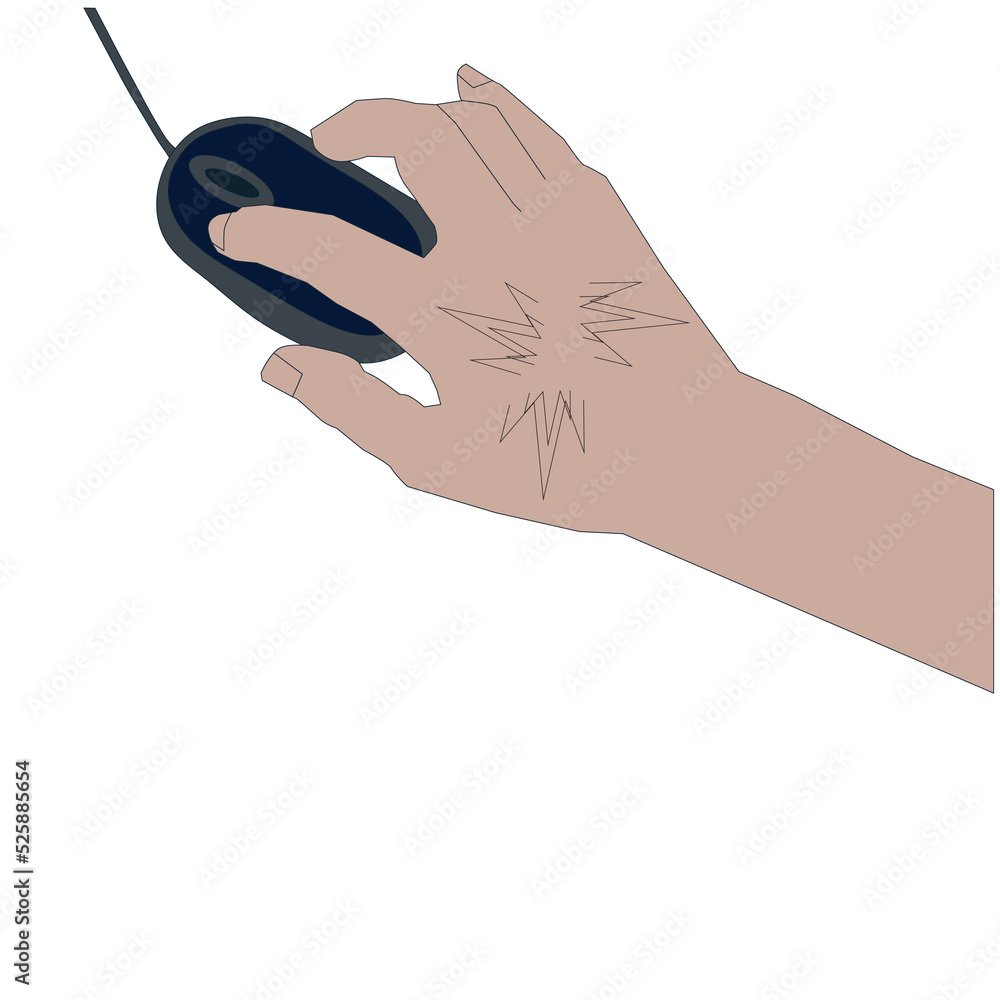 Vetor de Carpal tunnel syndrome stock illustration, Pain from using the