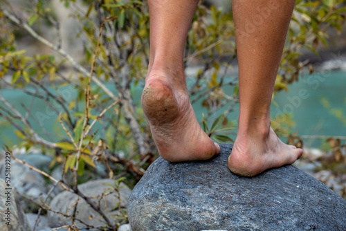 Feet without shoes on a stone on a summer day. Male traveler with rough heels with cracks.