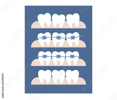 Dental braces icon. Orthodontic treatment and cosmetic odontology. Before after straightening teeth. Vector flat illustration 