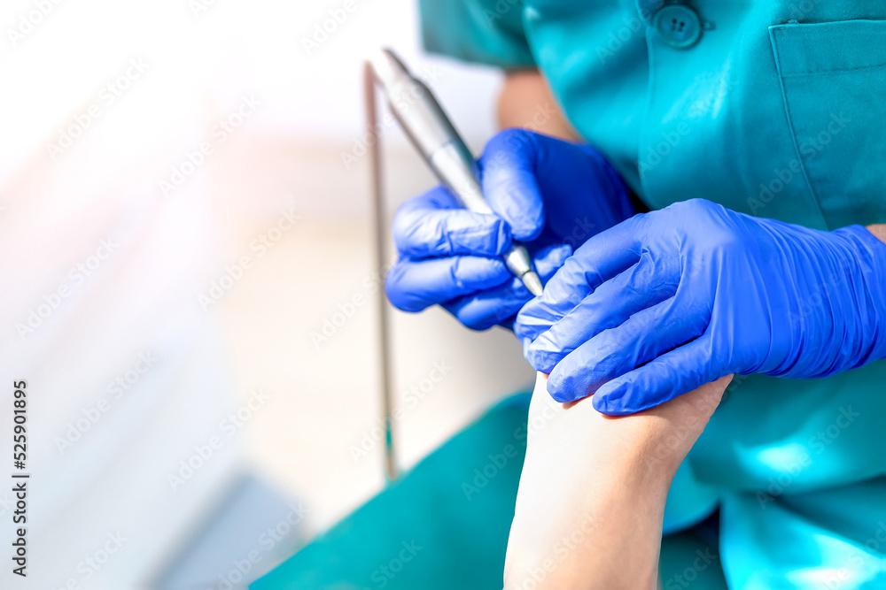 Close-up of a podiatry treatment. Selective focus Close-up of a podiatry treatment. Selective focus
