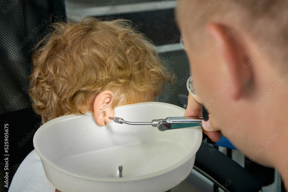 To wash ears with water irrigator, an experienced doctor substitutes a special funnel to child's ear to collect water. Close-up of procedure for cleaning children's ears from ear plugs in ENT room To wash ears with water irrigator, an experienced doctor substitutes a special funnel to child's ear to collect water. Close-up of procedure for cleaning children's ears from ear plugs in ENT room