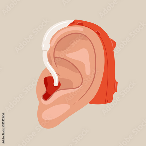 Hearing aid aerophone behind organ ear human health care close up. Vector illustration or icon design.